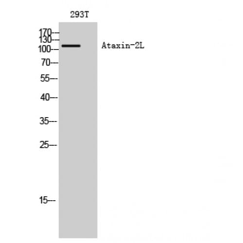 Polyclonal Rabbit anti-Human ATXN2L Antibody (540-620 aa, Internal, WB)