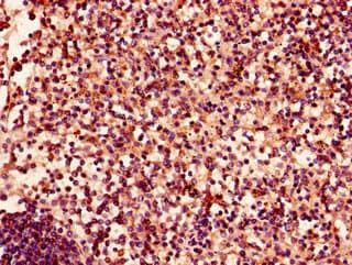 EPHA4 / EPH Receptor A4 Antibody