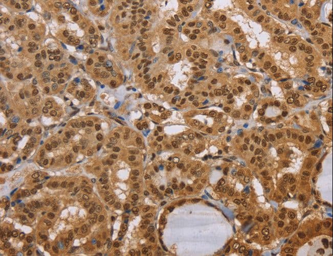 CEL / Carboxyl Ester Lipase Antibody