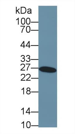 GSTA3 Antibody (aa1-222)