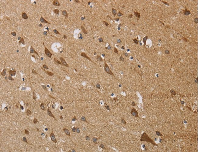 Polyclonal Rabbit anti-Human KCNMB4 Antibody (IHC, WB)