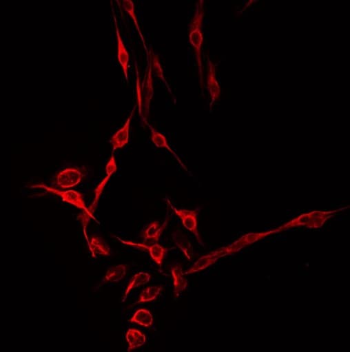 CHSY1 Antibody