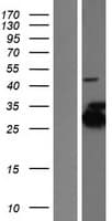 KCTD2 Protein (Over-Expression Lysate Myc-DDK (Flag))