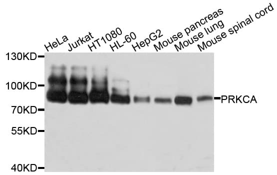 PRKCA / PKC-Alpha Antibody