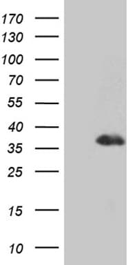 DLX1 Antibody (aa1-255, clone OTI3C5)
