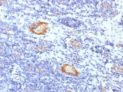 VWF / Von Willebrand Factor Antibody (aa1815-1939, clone VWF/1859R, Azide-free, Carrier-free)