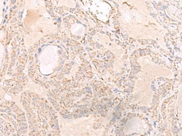 IGHA1 / IgA1 Antibody