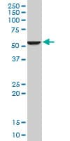 IHC-plus™ FADS1 Antibody (clone 2D9)