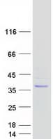 Human SUSD6 / KIAA0247 Protein (Recombinant Myc-DDK (Flag))
