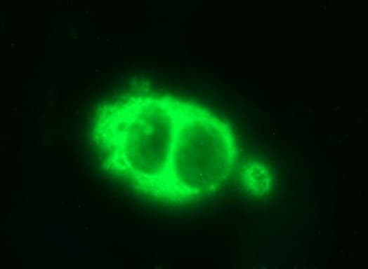 HSD17B4 Antibody (clone OTI4C4)