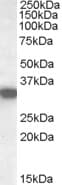 IHC-plus™ Polyclonal Goat anti-Human HADH Antibody (aa234-245, IHC, WB)