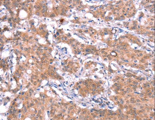 Polyclonal Rabbit anti-Human GAS8 Antibody (IHC)