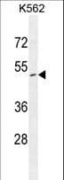 Polyclonal Rabbit anti-Human ZNF517 Antibody (aa459-489, WB)