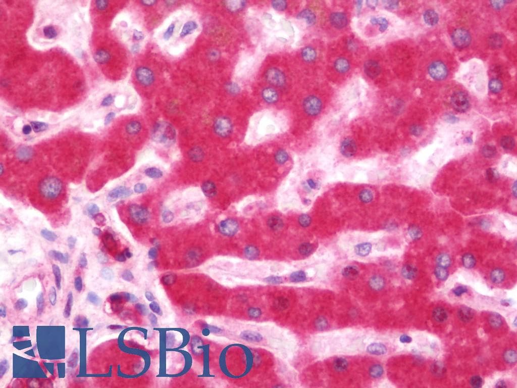 IHC-plus™ Polyclonal Rabbit anti-Human IKBKE / IKKI / IKKE Antibody (IHC, WB)