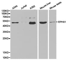 EPHX1 / Epoxide Hydrolase 1 Antibody