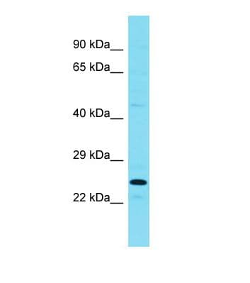 Polyclonal Rabbit anti-Mouse RPRD1B Antibody (aa112-161, WB)