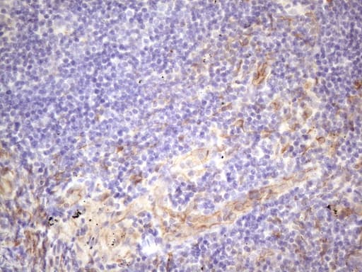 CSF2 / GM-CSF Antibody (aa18-144, clone OTI1A3, Carrier-free)