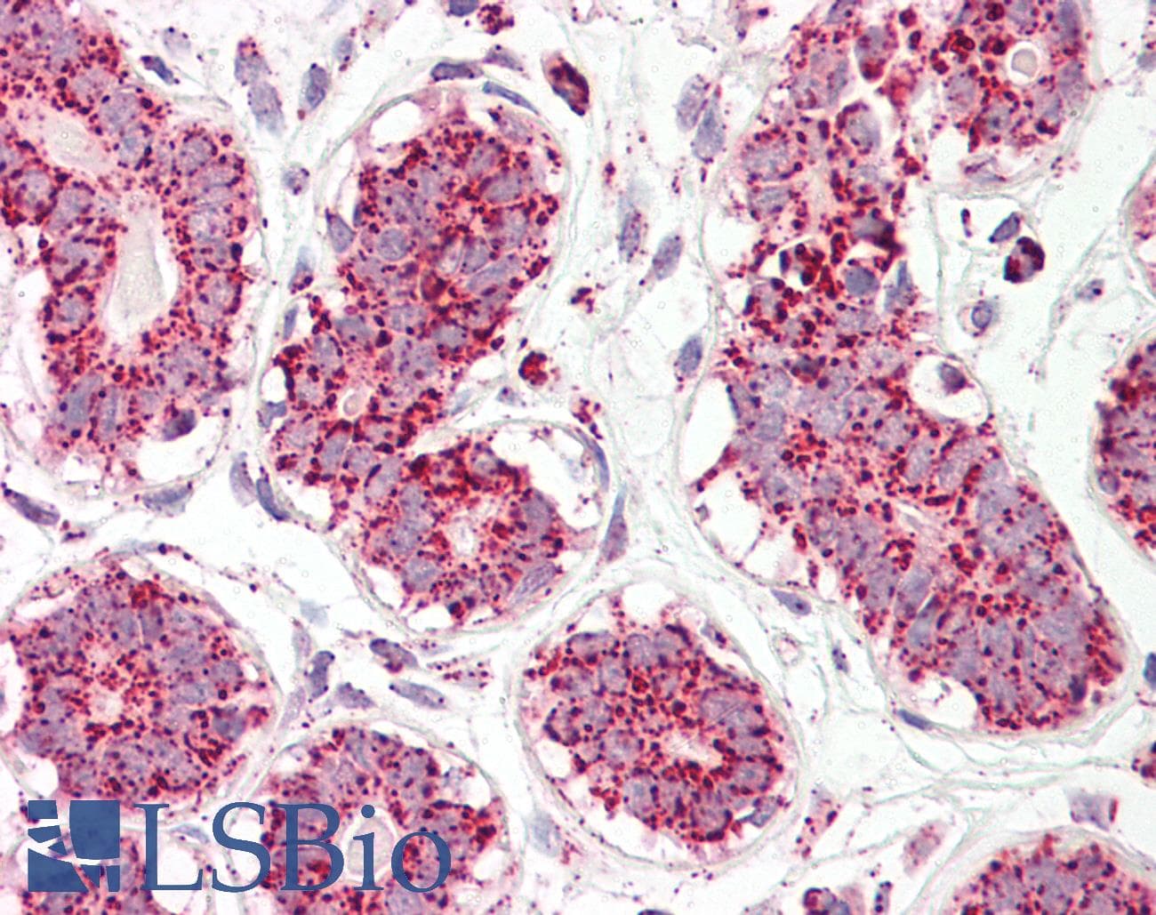 IHC-plus™ ACO2 / Aconitase 2 Antibody (aa554-566)