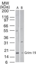 IHC-plus™ Polyclonal Rabbit anti-Human NDUFA13 / GRIM19 Antibody (IHC, WB)