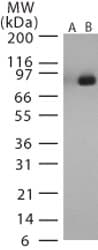 Polyclonal Rabbit anti-Bacillus anthracis LF / Lethal Factor Antibody (aa779-792, WB)