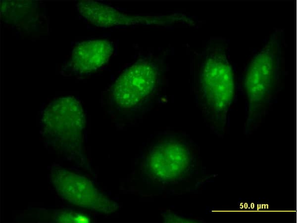 Vimentin Antibody (clone 3E9)