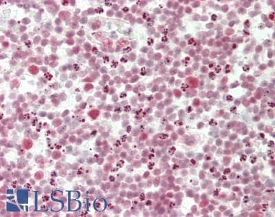 IHC-plus™ Polyclonal Rabbit anti-Human CPSF6 Antibody (aa501-551, IHC, IF)