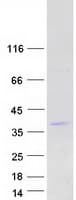 Human C19orf22 Protein (Recombinant Myc-DDK (Flag))