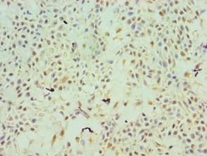 Polyclonal Rabbit anti-Human TFPI2 Antibody (aa23-235, IHC, WB)