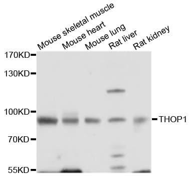 Polyclonal Rabbit anti-Human THOP1 / Thimet Oligopeptidase Antibody (WB)