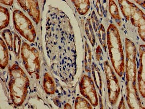 Polyclonal Rabbit anti-Human TMIGD2 Antibody (IHC, IF)