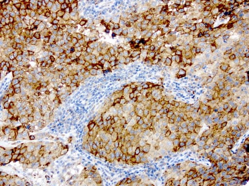 GBA / Glucosidase Beta Acid Antibody (aa40-315, clone UMAB171)