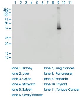 IHC-plus™ HSD3B1 Antibody (clone 3C11-D4)
