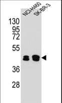 KRT80 / Keratin 80 Antibody (aa404-432)