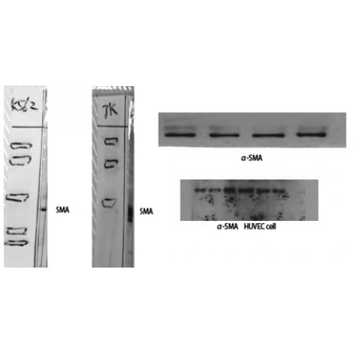 Polyclonal Rabbit anti-Human ACTA2 / Smooth Muscle Actin Antibody (N-Terminal, IHC, WB)