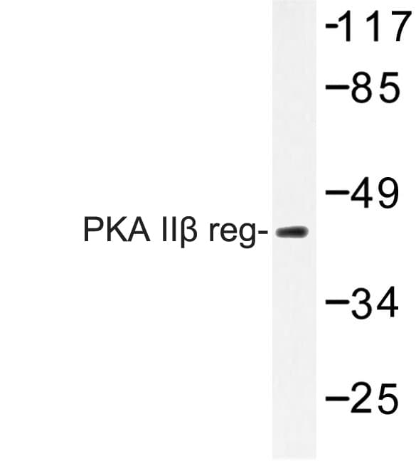 PRKAR2B Antibody (Thr109)