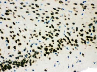 SMN1/SMN2 Antibody