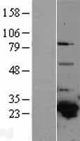GSTA4 Protein (Over-Expression Lysate Myc-DDK (Flag))