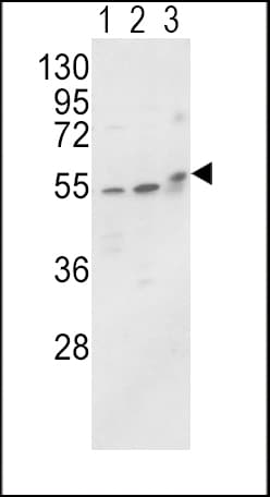 ALPL / Alkaline Phosphatase Antibody (aa3-32)