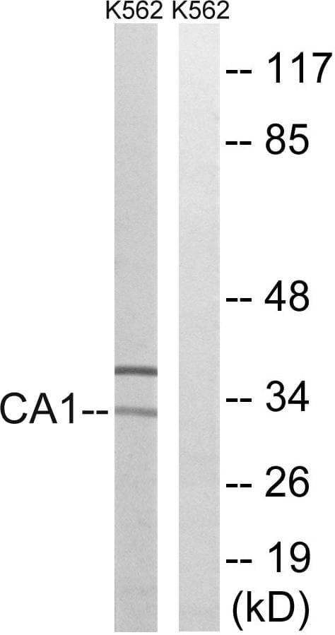 CA1 / Carbonic Anhydrase I Antibody