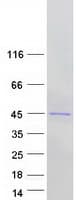 Human NUDT19 Protein (Recombinant Myc-DDK (Flag))