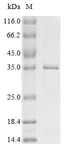 Porcine Parvovirus NS1 Protein (Recombinant 10His, N-terminus + Myc, C-terminus)