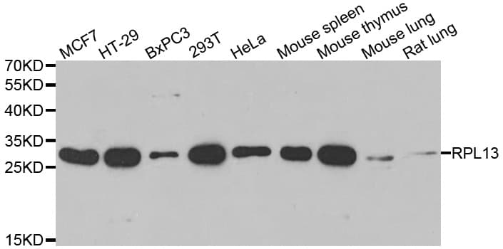 RPL13 / Ribosomal Protein L13 Antibody