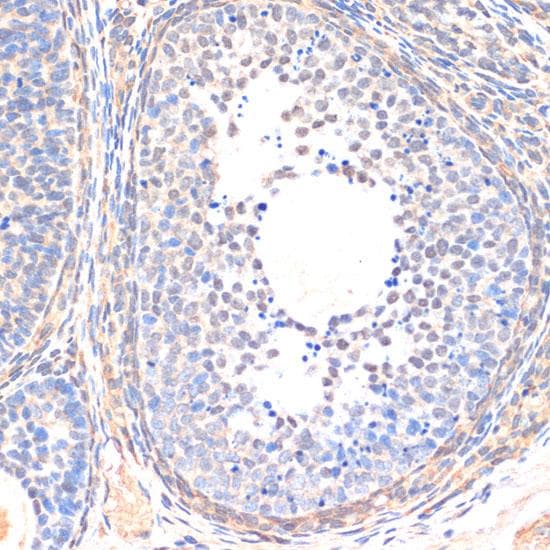 SMAD5 Antibody