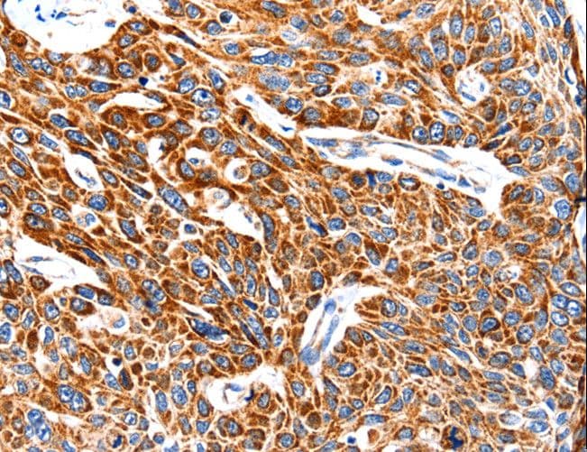 TRAP1 / HSP75 Antibody