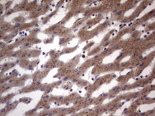 BFSP1 / Filensin Antibody (aa405-665, clone OTI3H6)