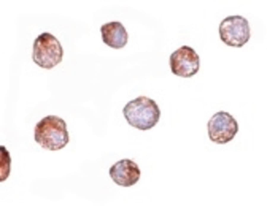 IHC-plus™ Fibulin-3 / EFEMP1 Antibody