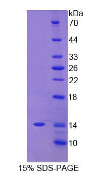 Human CEACAM7 Protein (Recombinant His)