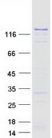 Human DNMT3A Protein (Recombinant Myc-DDK (Flag))