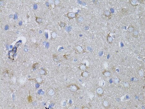 MYH10 Antibody