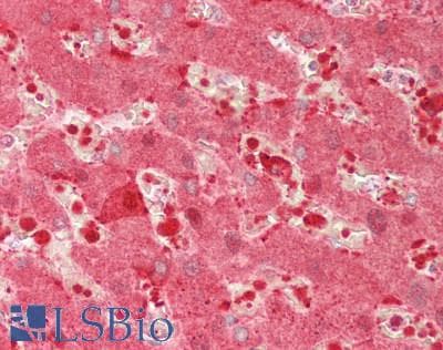 IHC-plus™ CA2 / Carbonic Anhydrase II Antibody (aa2-260)
